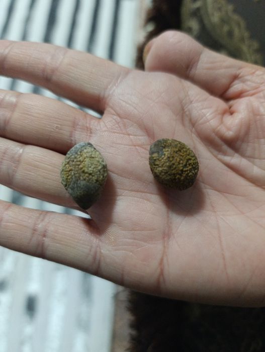 Продам камни желчного пузыря челов.