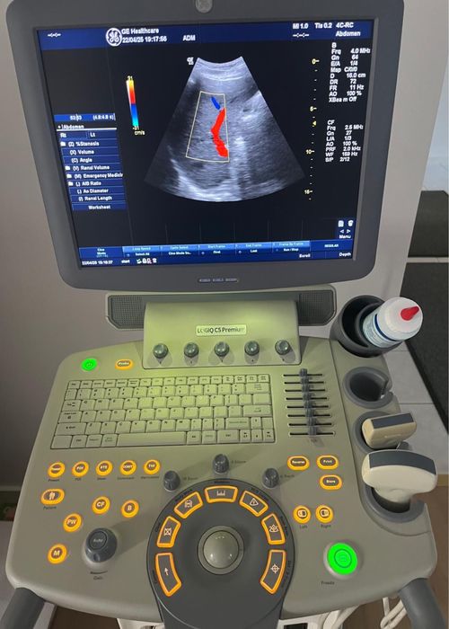 Ecograf ge logiq c5 premium