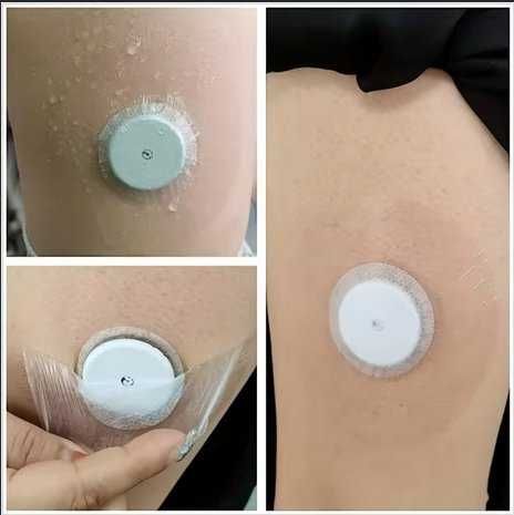 Set 20 plasturi patch senzor glicemie CGM