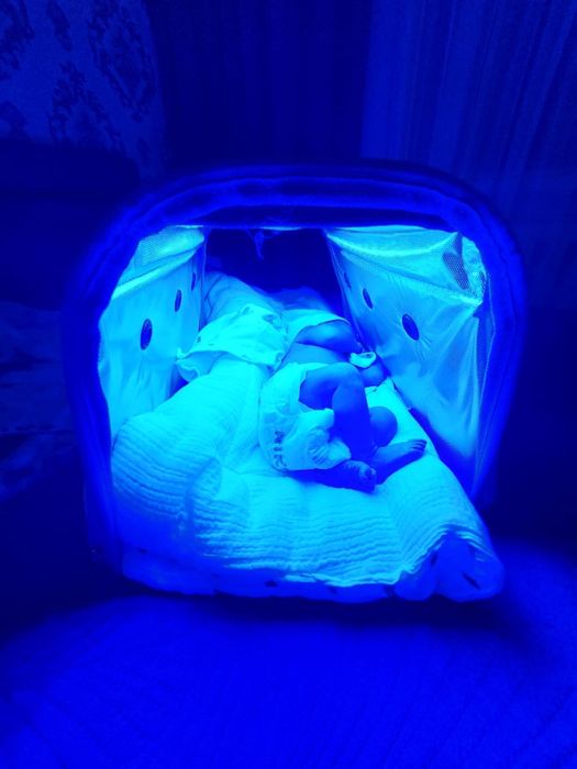 Лампа от желтушки 1000к день