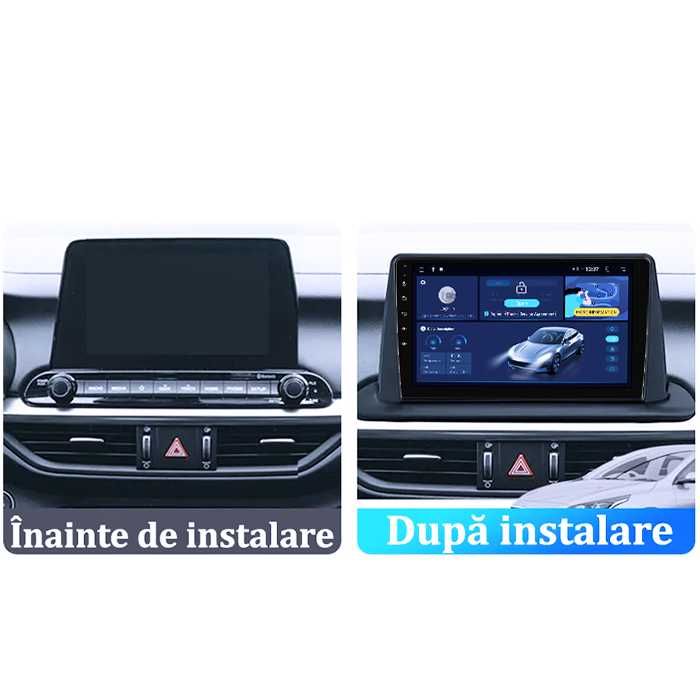 Navigatie KIA Cerato 4 2018-2021, Android 14,9 INCH, 4GB RAM/64GB ROM