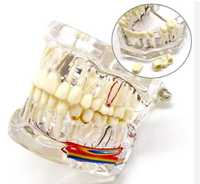 Модель зубного имплантата