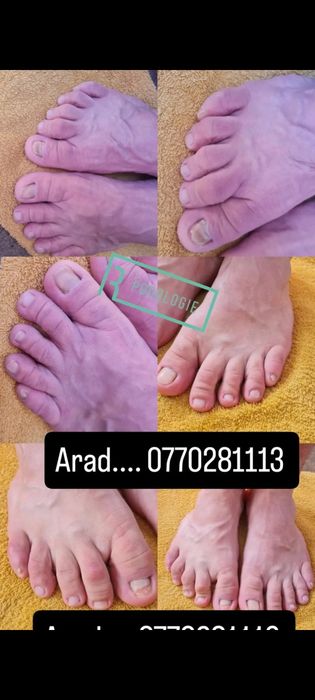 Manichiura și pedichiura profesională podologica la domiciliu