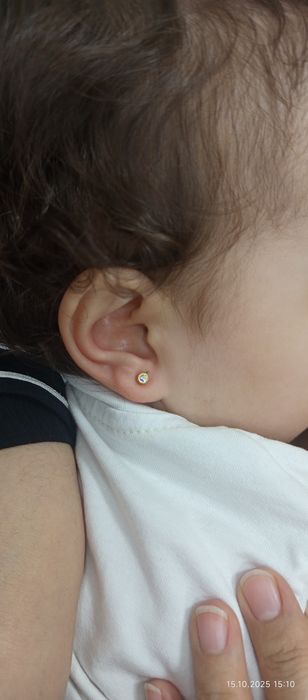 Quloq Burun teshish xizmati endi sizning xonadoningizda