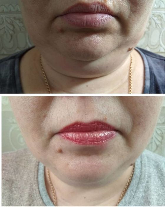 Сжиросжигающий коктейль. Лицо, второй подбородок. Тело