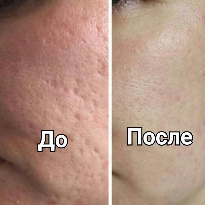 100% tabiy collagen ulitkalar sotuvda bor