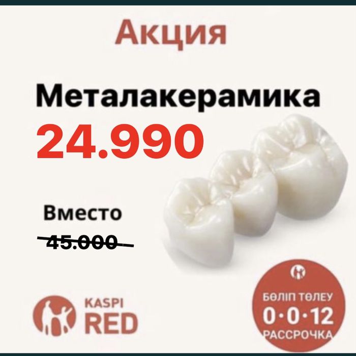 Металлокерамика . Зубные коронки.