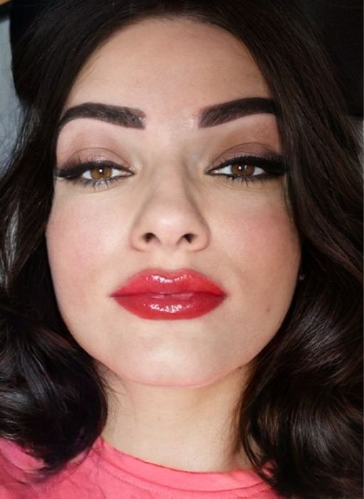 Rinoplastie, mărire buze, micropigmentare