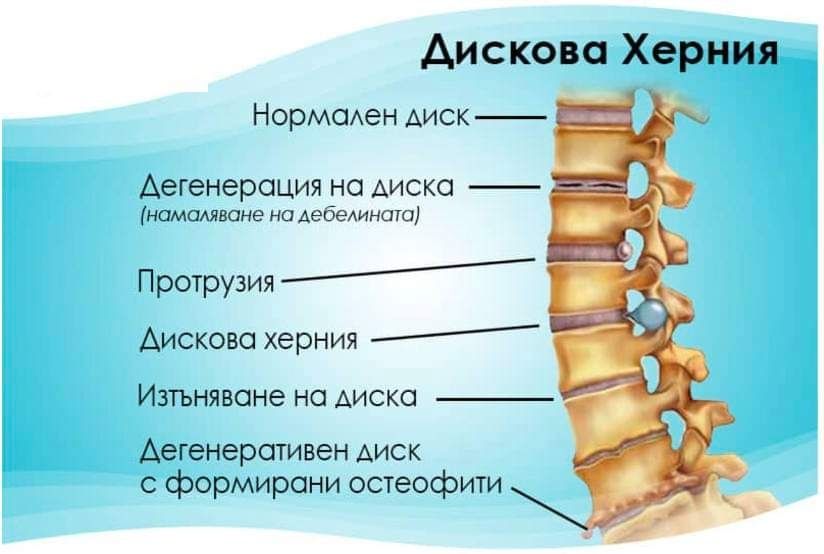 Артропласт Гел-Vertera- Здрави стави!