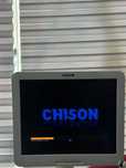 УЗИ CHISON I3  Стационар аппарат