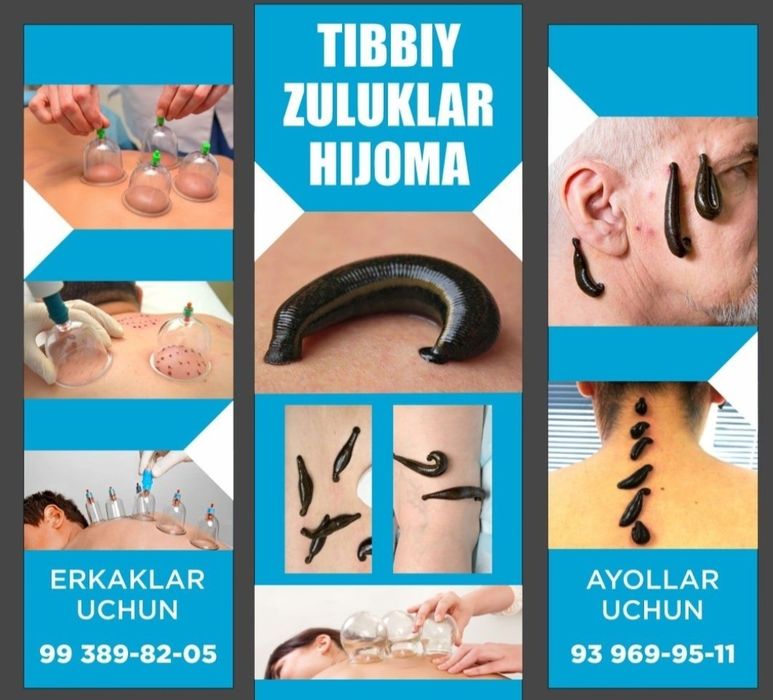 Тиббий зулуклар медицинские пиявки