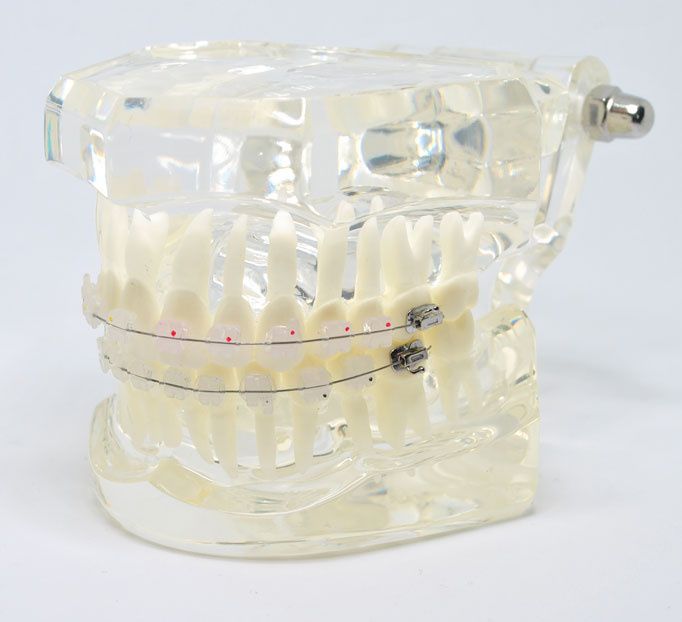 Model typodont orto transparent cu bracketi ceramici tipodont