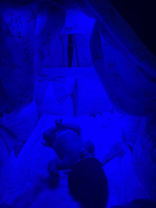 Fototerapiya/ fotolampa kichkinasi va kottasi