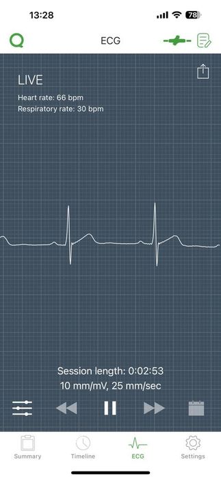 Qardio Core monitorizare cardio schimb cu  Garmin Zumo