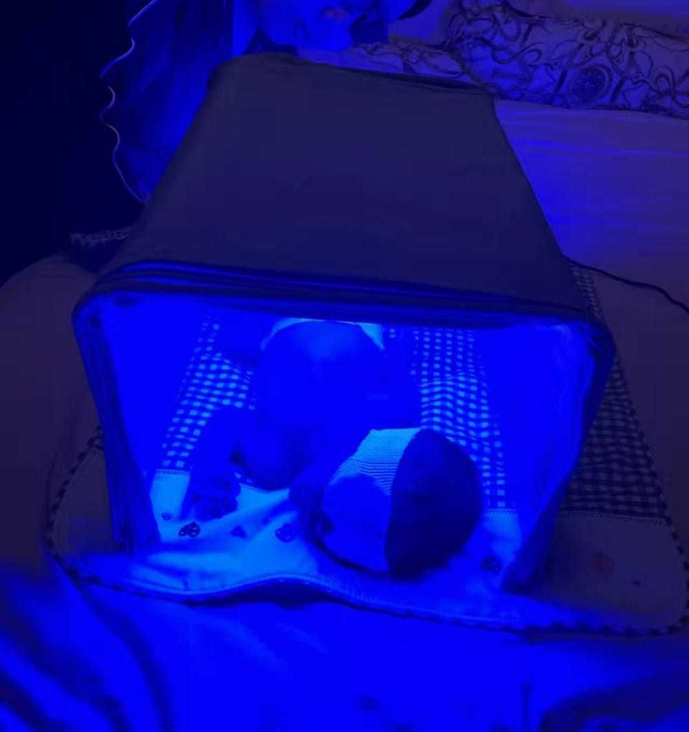 Фотолампа кювез от желтухи у новорожденных.Фотолампа бокс+БИЛИТЕСТ