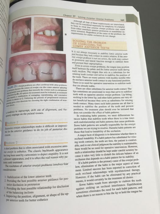 Functional Occlusion from TMJ to Smile Design-Peter E. Dawson