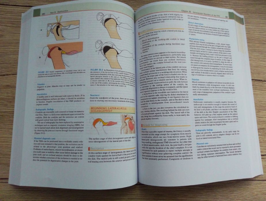 Functional Occlusion. From TMJ to Smile Design, Peter E. Dawson