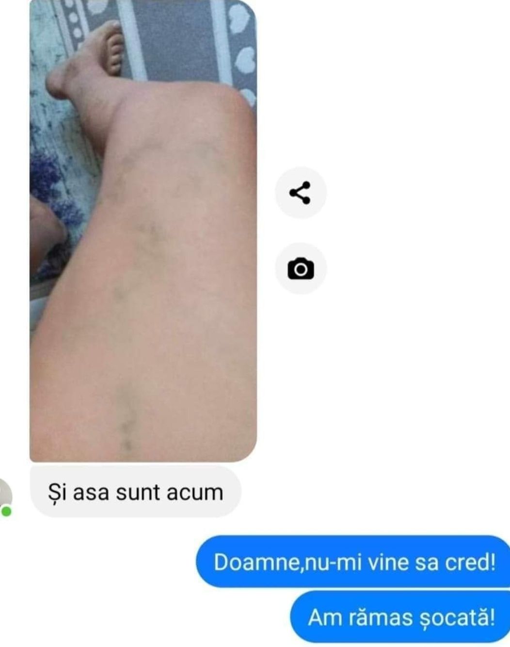 Cum am scăpat eu de durerile de picioare,picioare grele și umflate!