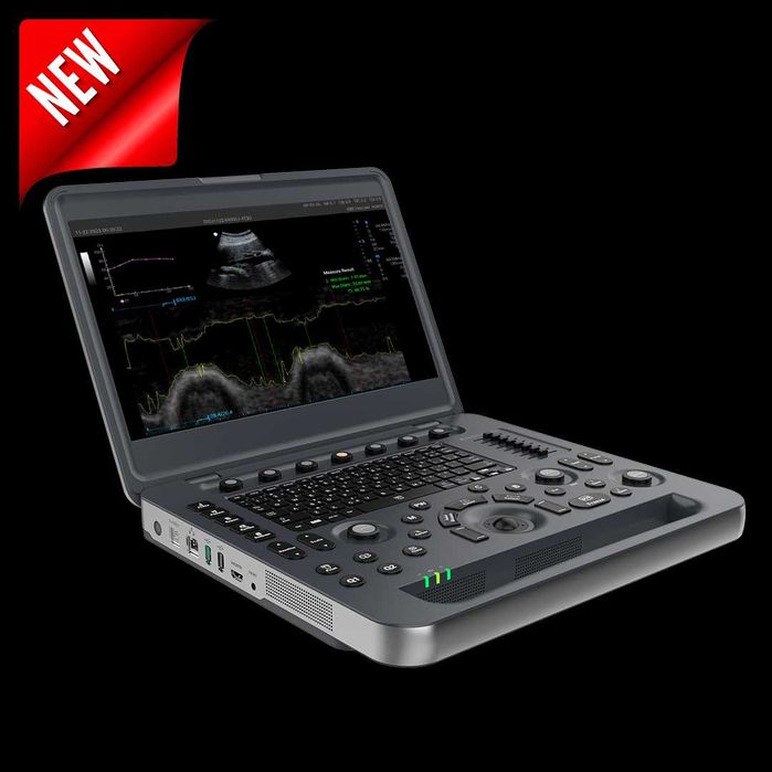 Оборудования Рассрочка МРТ, МСКТ, Ангиография, УЗИ аппарат в Ташкенте.