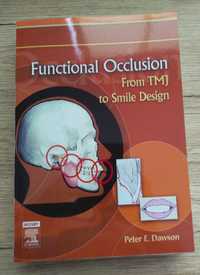 Functional Occlusion. From TMJ to Smile Design, Peter E. Dawson
