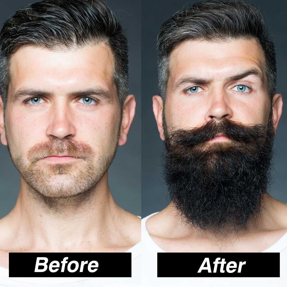 Мъжки комплект за растеж на брада Ускорител за растеж на косата