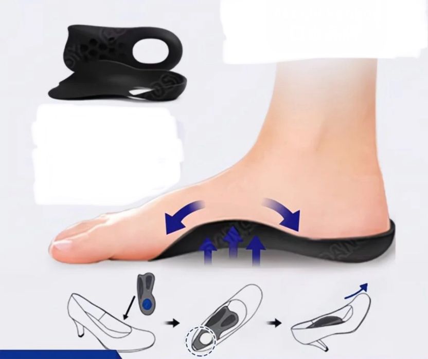 плоскостопие, корректирующие стельки,