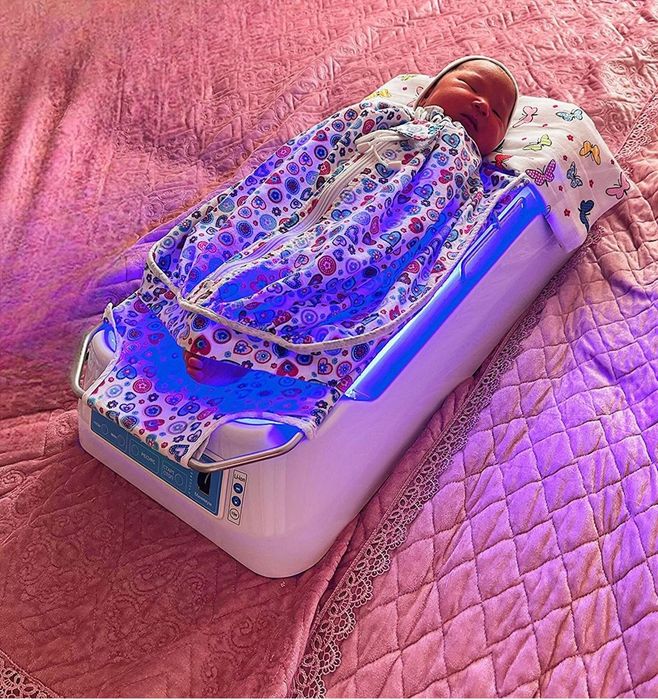 Прокат фотолампы от желтушки(желтухи)