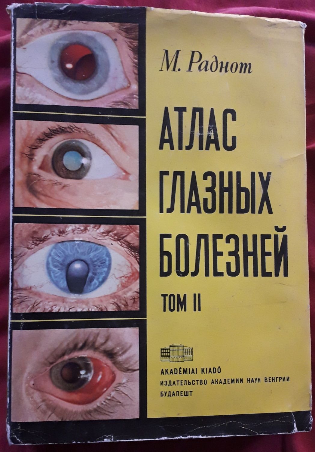 1)Экстренные операции.2) Атлас глазных болезней. 3)Хирургия катаракты.