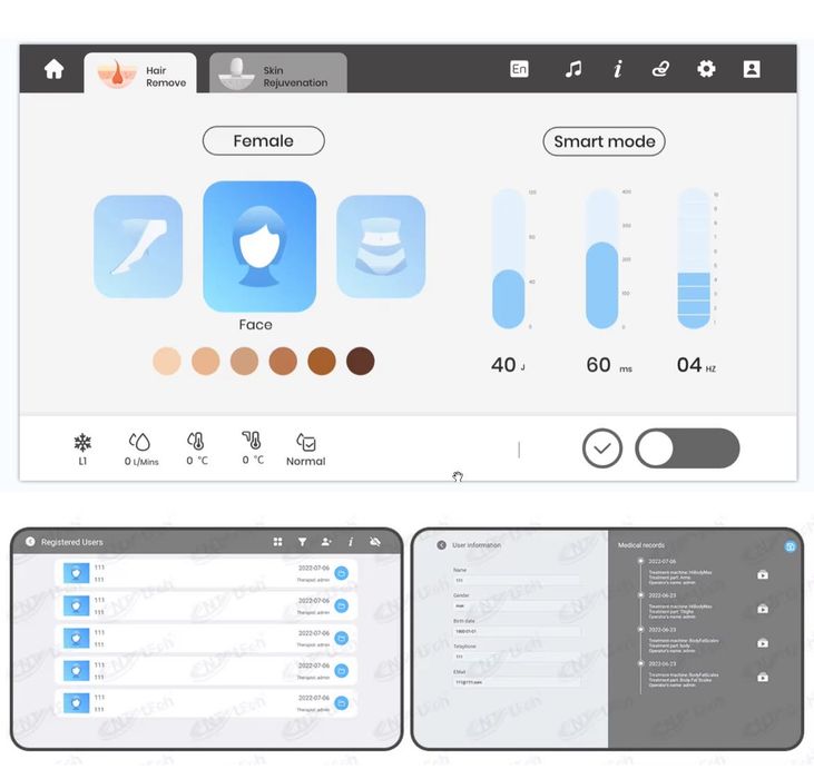 Диодна лазерна машина