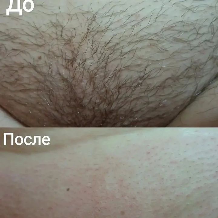 Шугаринг Уральск. Все зоны. Работаю с сахарной пастой