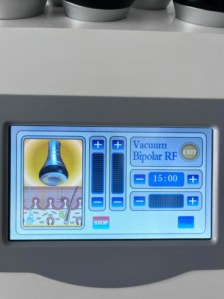 Aparat ultrasunet/radiofrecventa