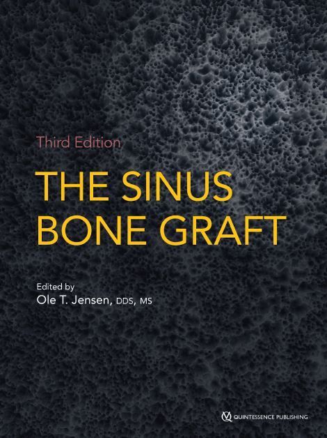 Bone Graft Sinus - Ole T. JENSEN - 2019- 3ed Edition