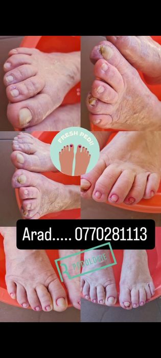 Manichiura și pedichiura profesională podologica la domiciliu