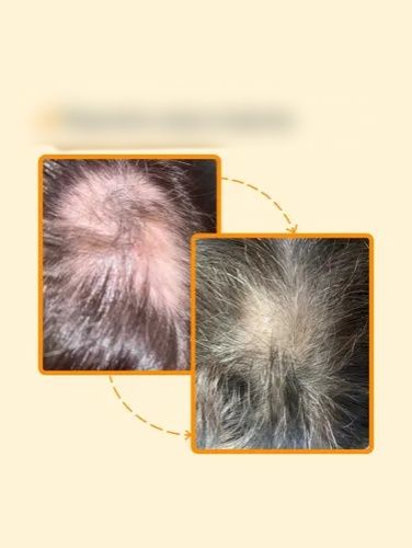 Средство для роста волос