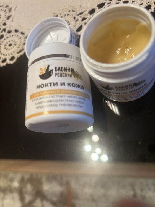 Гъбички по нокти. Крем и още нещо