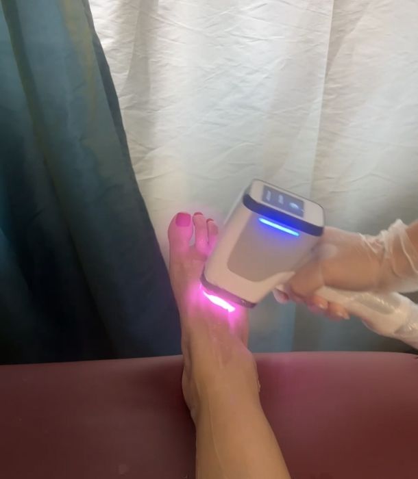 Epilare definitivă laser