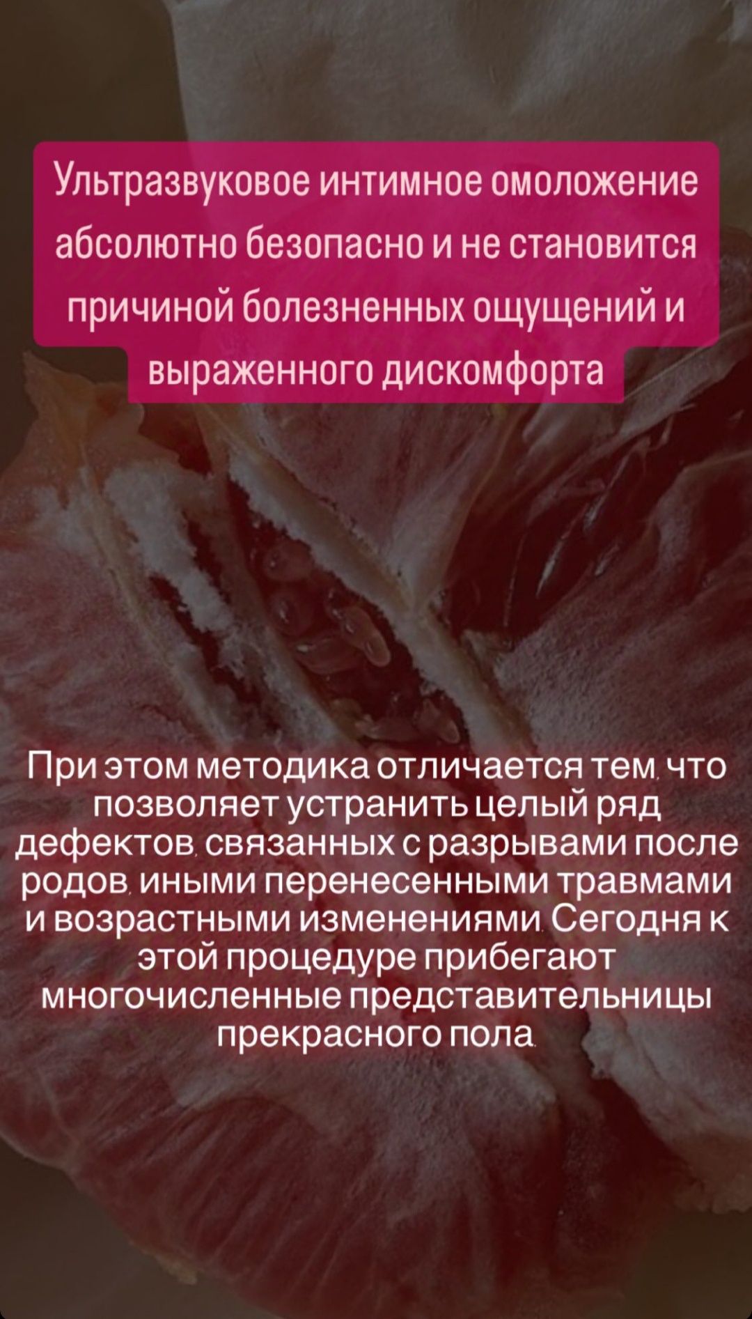 Ультразвуковое интимное омоложение