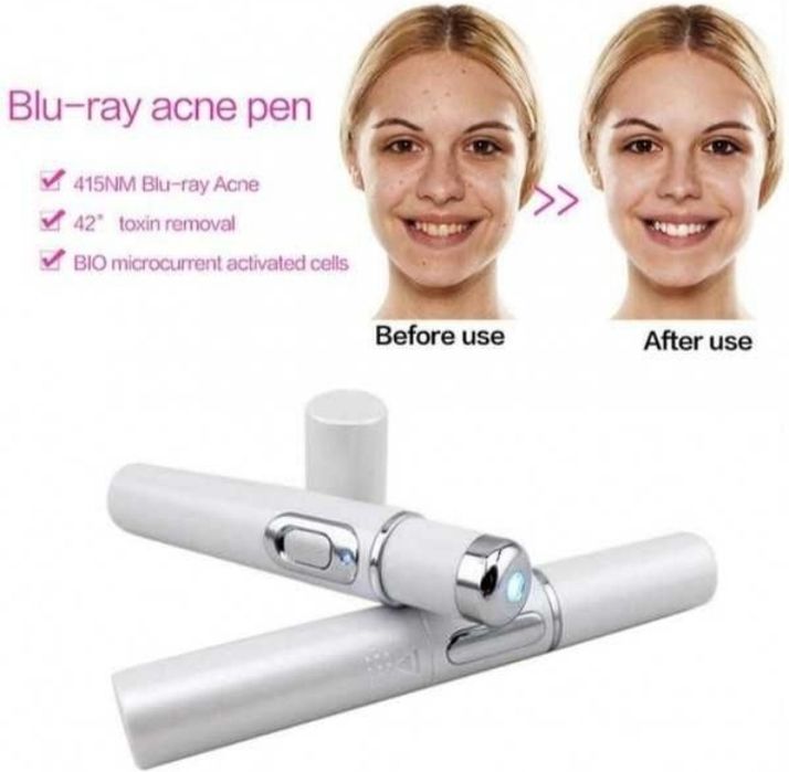 Pix cu laser pentru acnee
