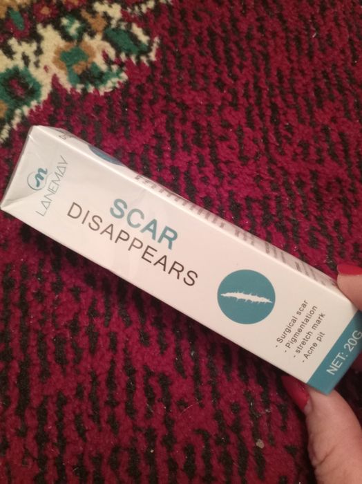 Chandiq ketkazadigan krem