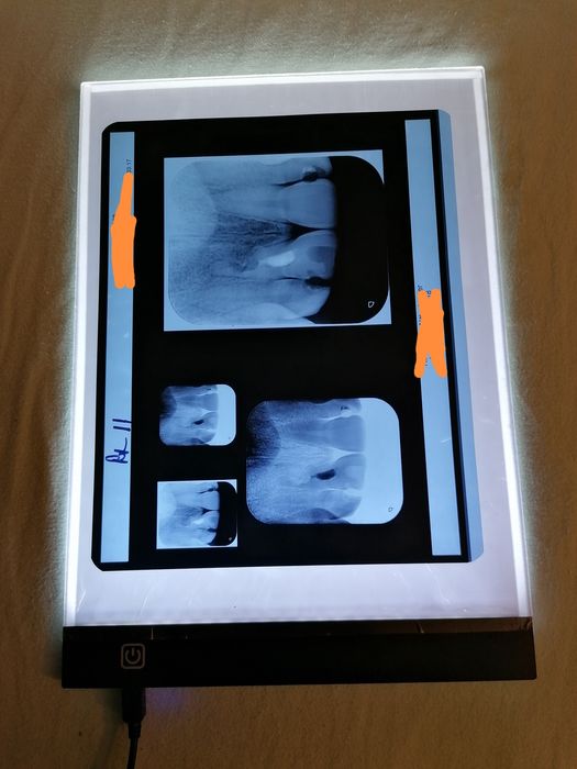 Panou  luminos radiografie, desen, 3 trepte de intensitate luminoasa