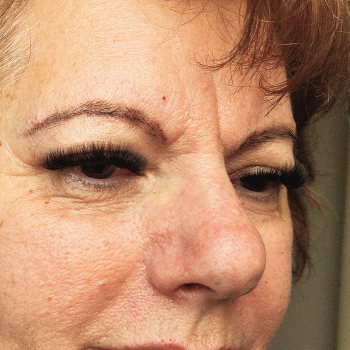 Extensii gene de la 2D până la Soft Volume