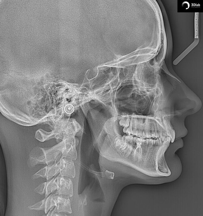 Цифровой рентген аппарат арендага берилади.