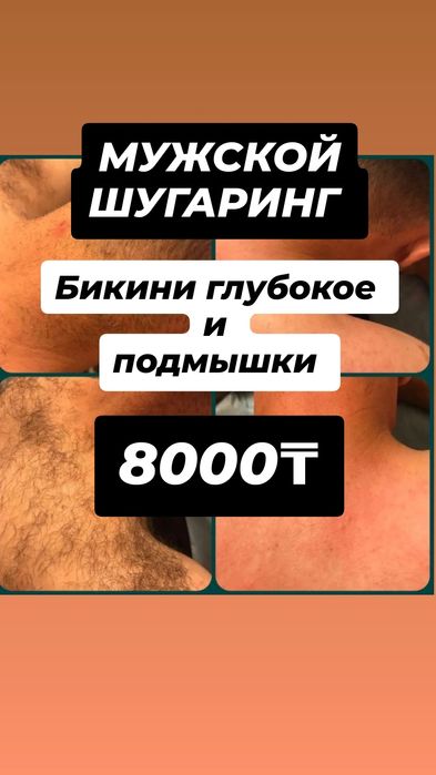 Шугаринг мужской