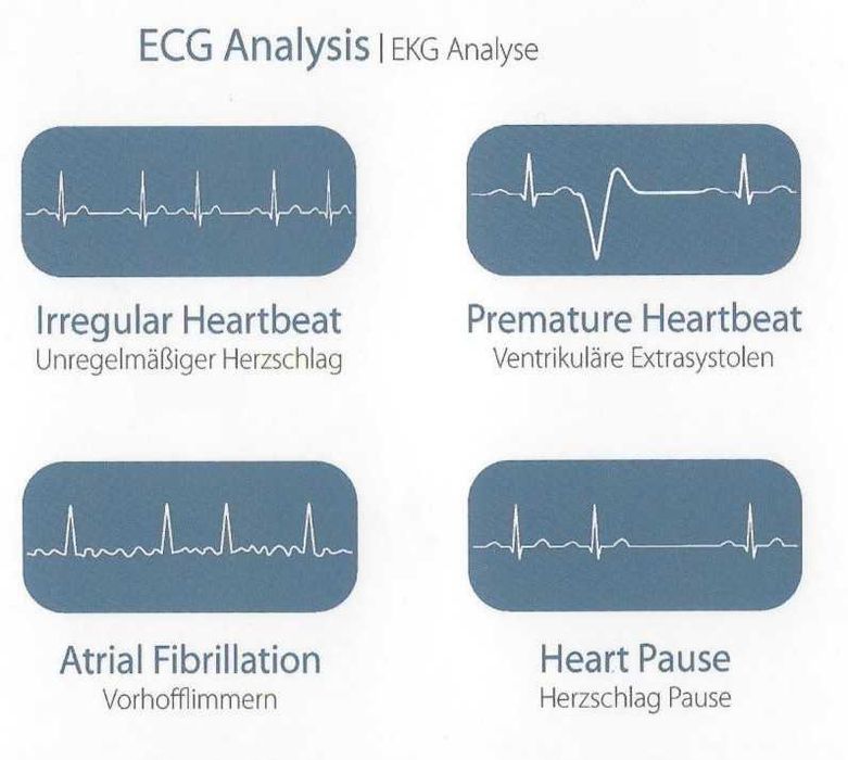 Holter EKG portabil / Monitor EKG - HeartMate - VIATOM, ecran color