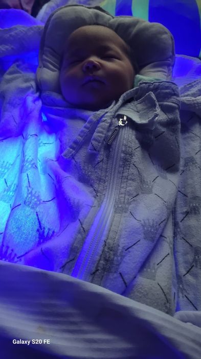 Фотолампа от желтушки