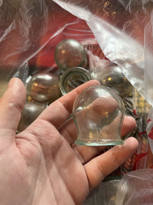 Вакуумные банки