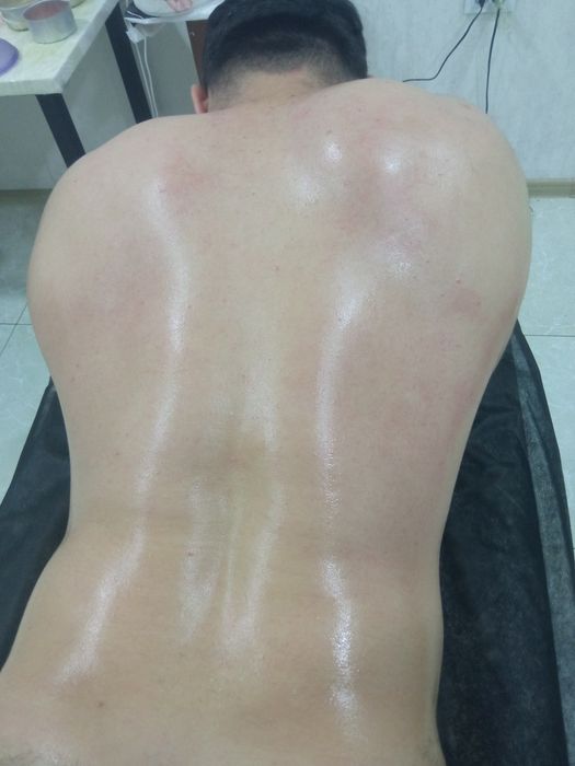 Депиляция мужская и женская