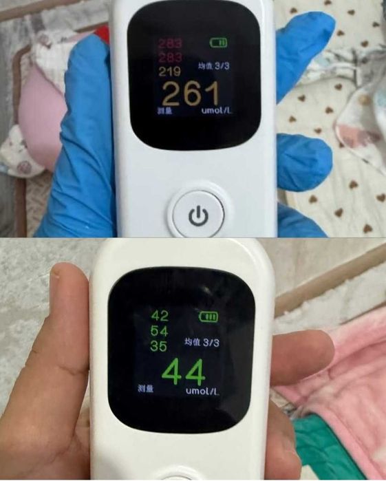 Fotolampa fototerapiya ot jeltuxi v arendu na dom