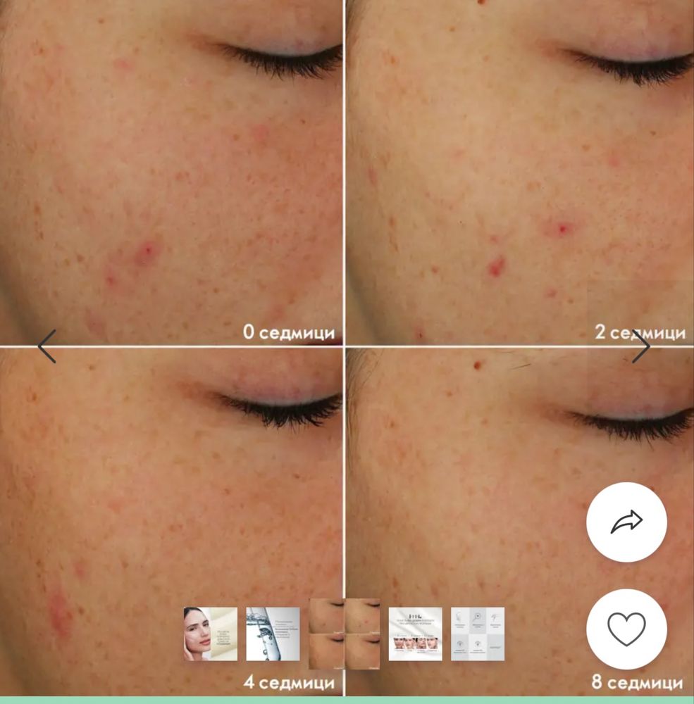 Лека програма Blemish + Age Defy