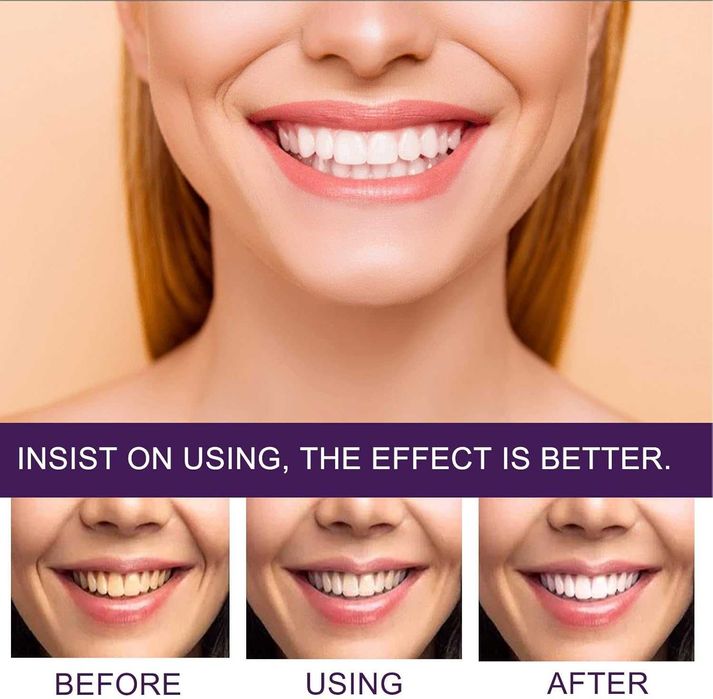 Избелваща паста за зъби, Паста за избелване на зъби Purple Corrector